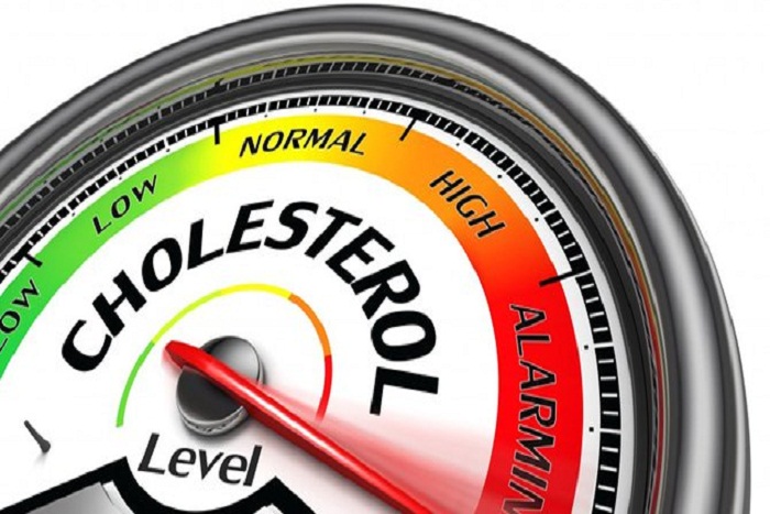 Kenali Ciri-Ciri Kolesterol Tinggi Sejak Dini