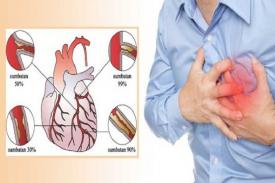 Gejala Penyakit Jantung yang Perlu di Waspadai dan Cara Pengobatannya
