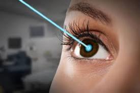 Teknologi LASIK Modern Lebih Cepat, Lebih Aman, Lebih Presisi