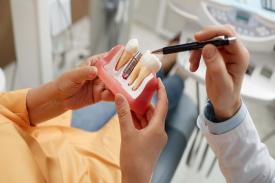 Keunggulan Implan Gigi Bagi Orang yang Memiliki Masalah Gigi